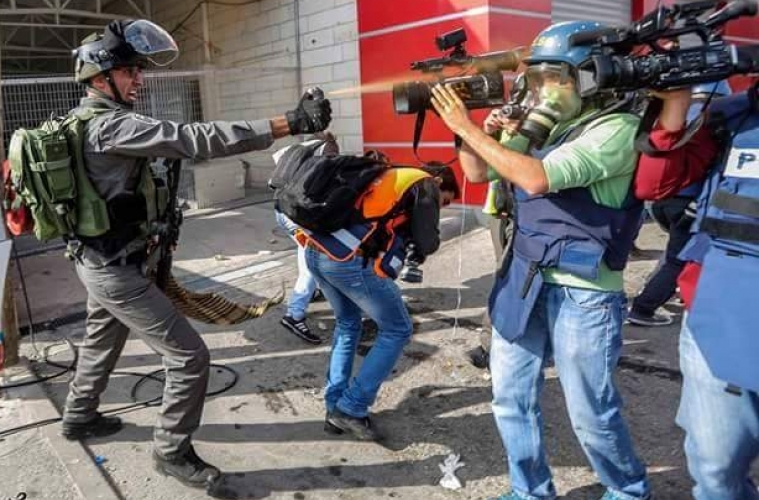 اصابة 3 فلسطينيين باعتداءات الاحتلال في الضفة الغربية