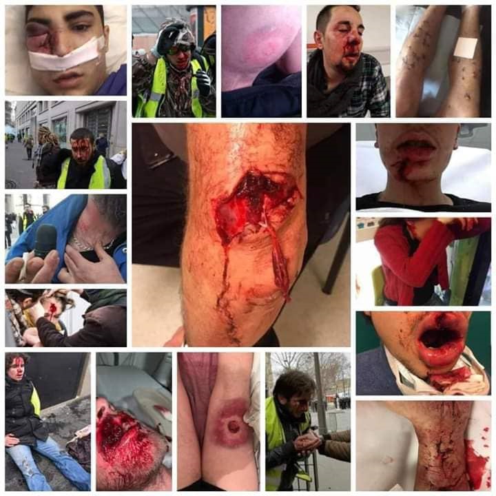 Manifestantes "Chalecos Amarillos" brutalmente reprimidos por la policía francesa