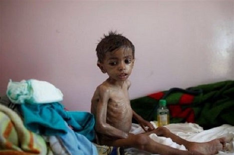 Af Örgütü: BAE, Yemen’de Savaşan Milis Gruplara Batı Menşeli Silahları Sevk Ediyor