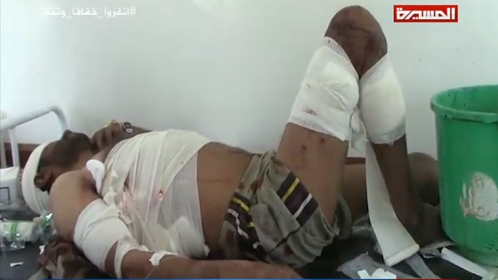 12 شهيدا وجريحا من أسرة واحدة بغارات لطيران العدوان على كُشر حجة 