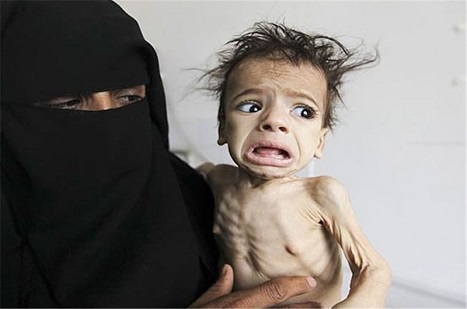İngiltere'nin Yemen'de Rolü