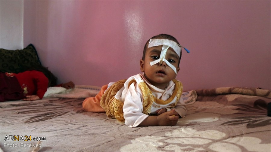 Photos: Humanitarian crisis in Yemen