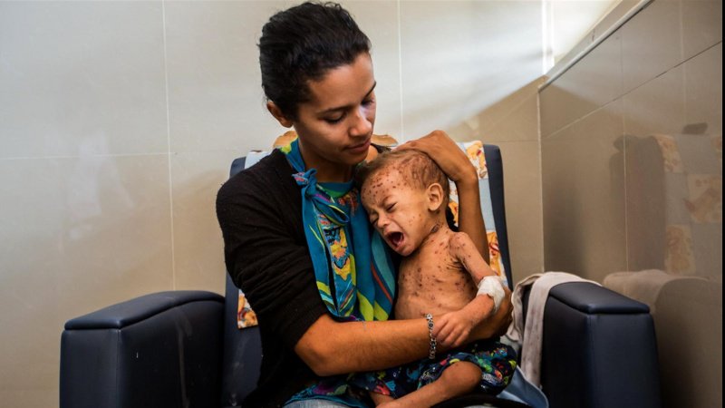 Venezuela, Unicef: oltre 3 milioni di bambini hanno bisogno di aiuti umanitari