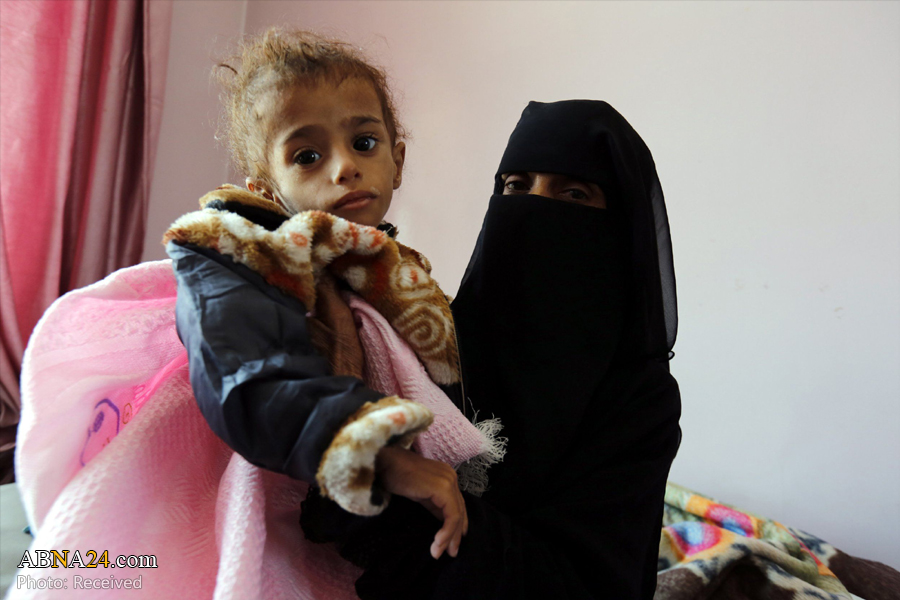 Yemen lives world largest humanitarian crisis ever known for over century