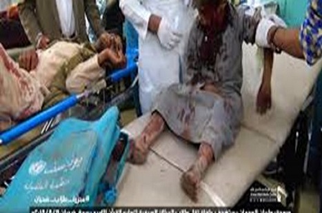 BM: Yemen’de 7500 çocuk öldü, ya da sakat kaldı