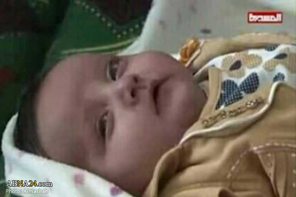 Yemeni infant dies after Saudi aggression refused to allow travel abroad for treatment