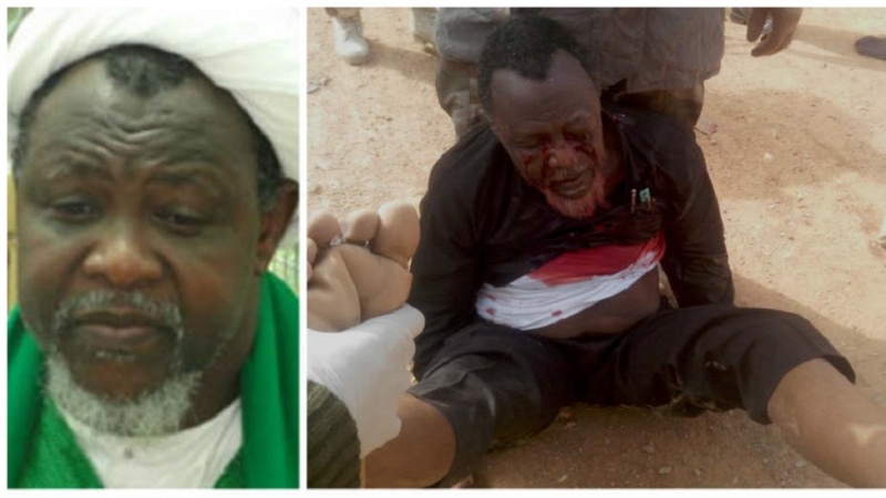 Chama cha madaktari Iran chaonya kuhusiana na hali ya Sheikh Ibrahim Zakzaky Chama cha madaktari Iran chaonya kuhusiana na hali ya Sheikh Ibrahim Zakzaky