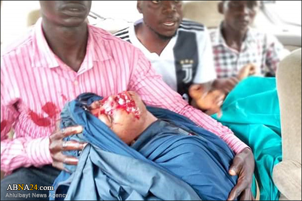Photos: Nigerian police kill 11 protesters demanding release of Sheikh Zakzaky