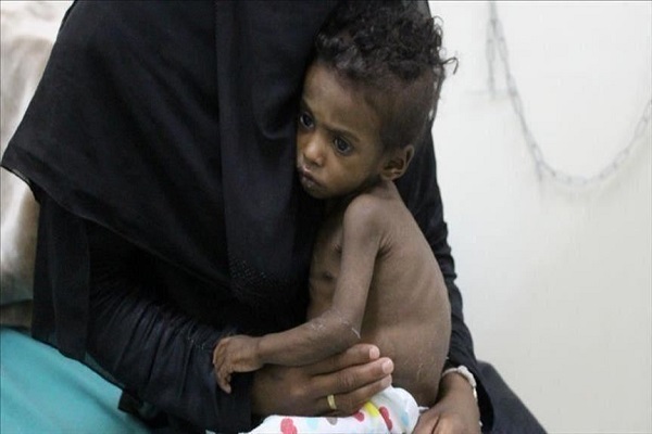  ONU: 24 millions Yéménites souffrent de malnutrition