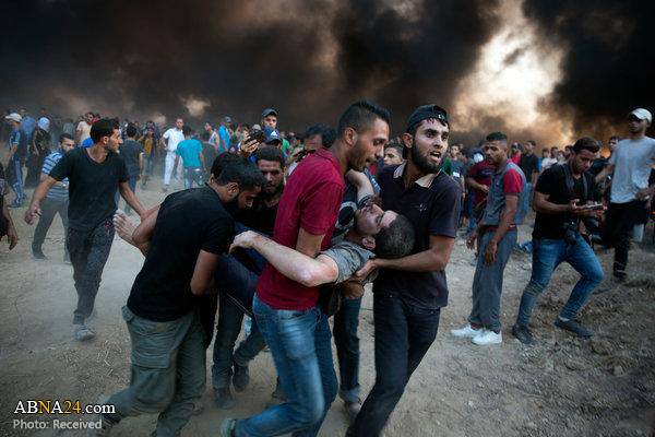 Israeli forces injure over 50 Palestinians in Gaza