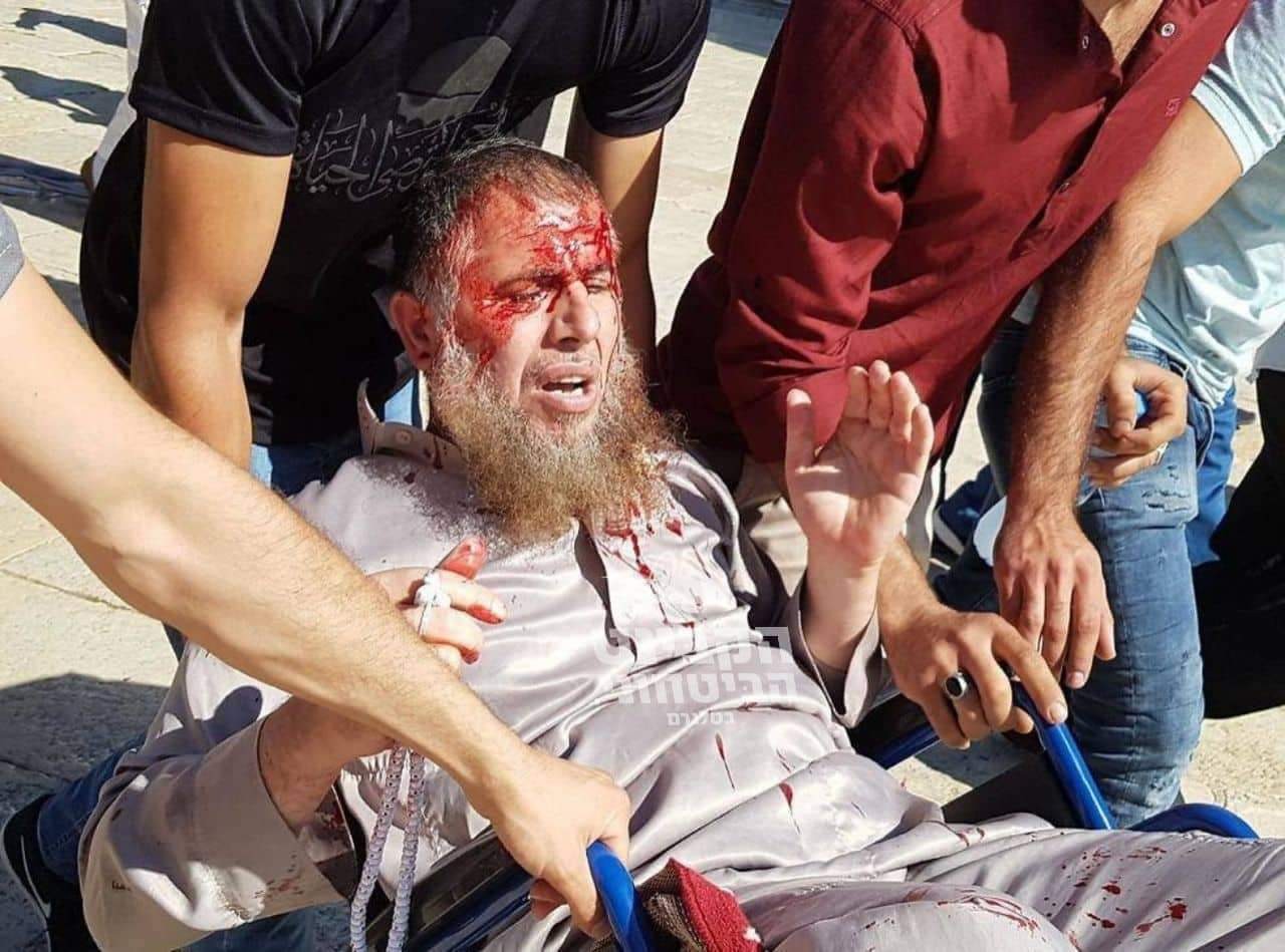 مواجهات عنيفة بين المصلين وشرطة الاحتلال الإسرائيلية بالمسجد الأقصى+(صور)