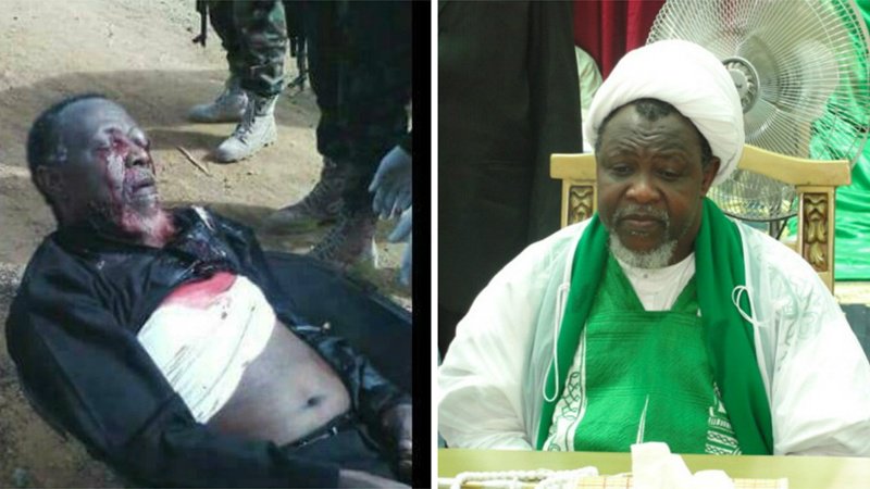 آیت اللہ زکزکی کی ابتر جسمانی حالت کے بارے میں سات ملکوں کے ڈاکٹروں کا اظہار تشویش