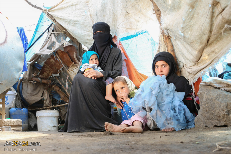 Because of aggression, 79% of Yemeni people live below poverty line