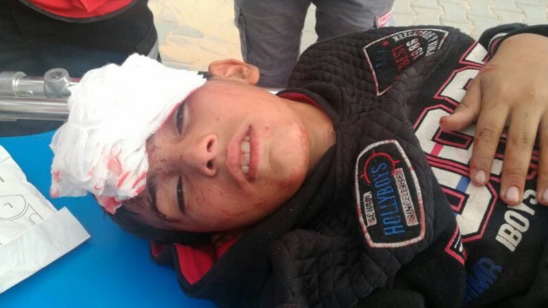 Cionistički pucnji u pravcu palestinske djece