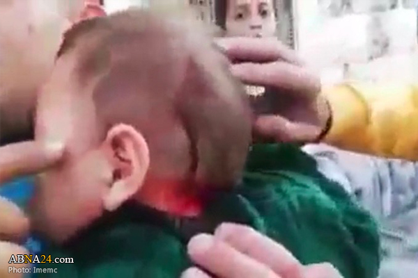 Israeli settlers injure Palestinian toddler in head