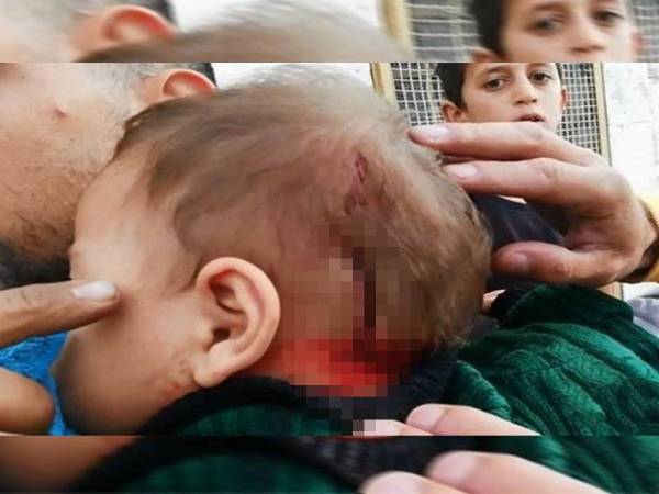 Bayi Palestin Cedera Dibaling Batu