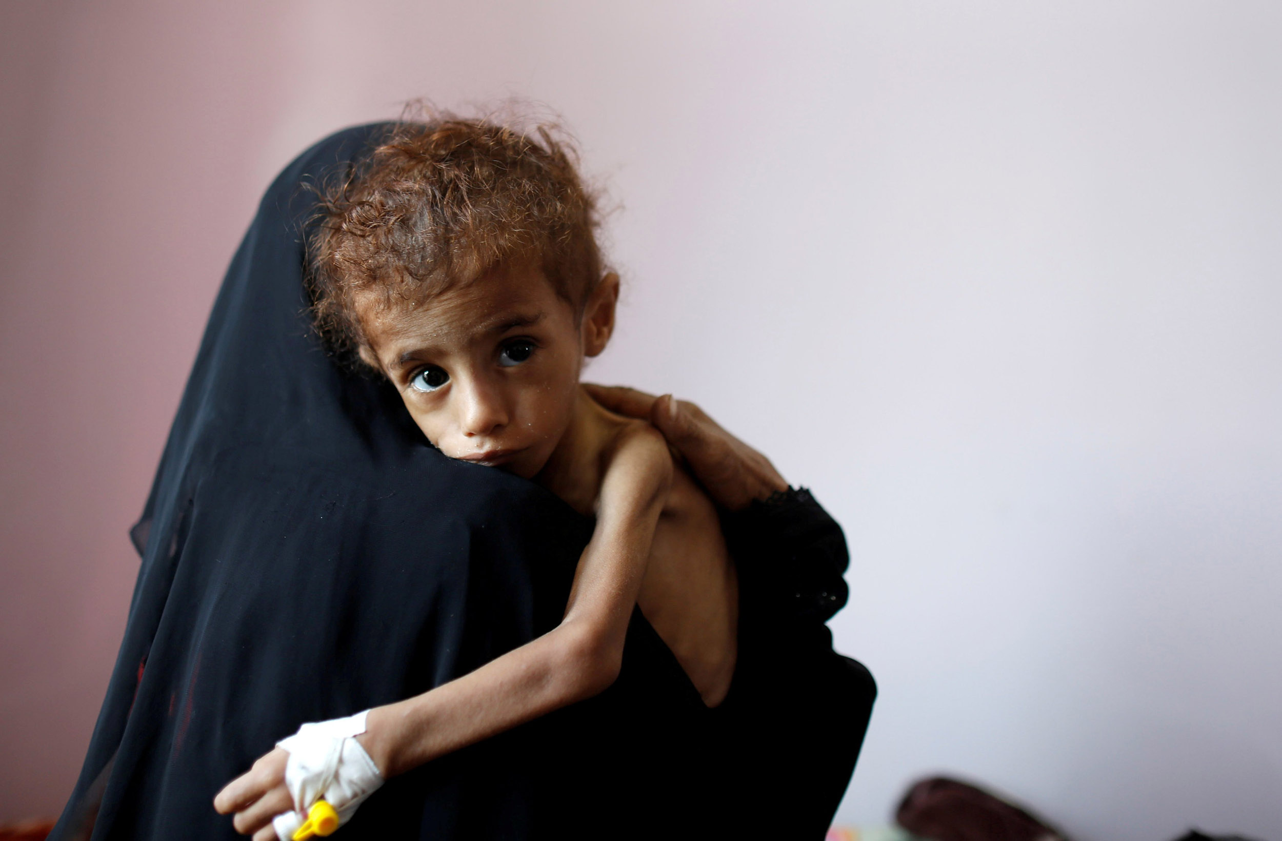 Yemen corren riesgo de morir de hambre, en lo que podría ser la “peor hambruna en 100 años” 