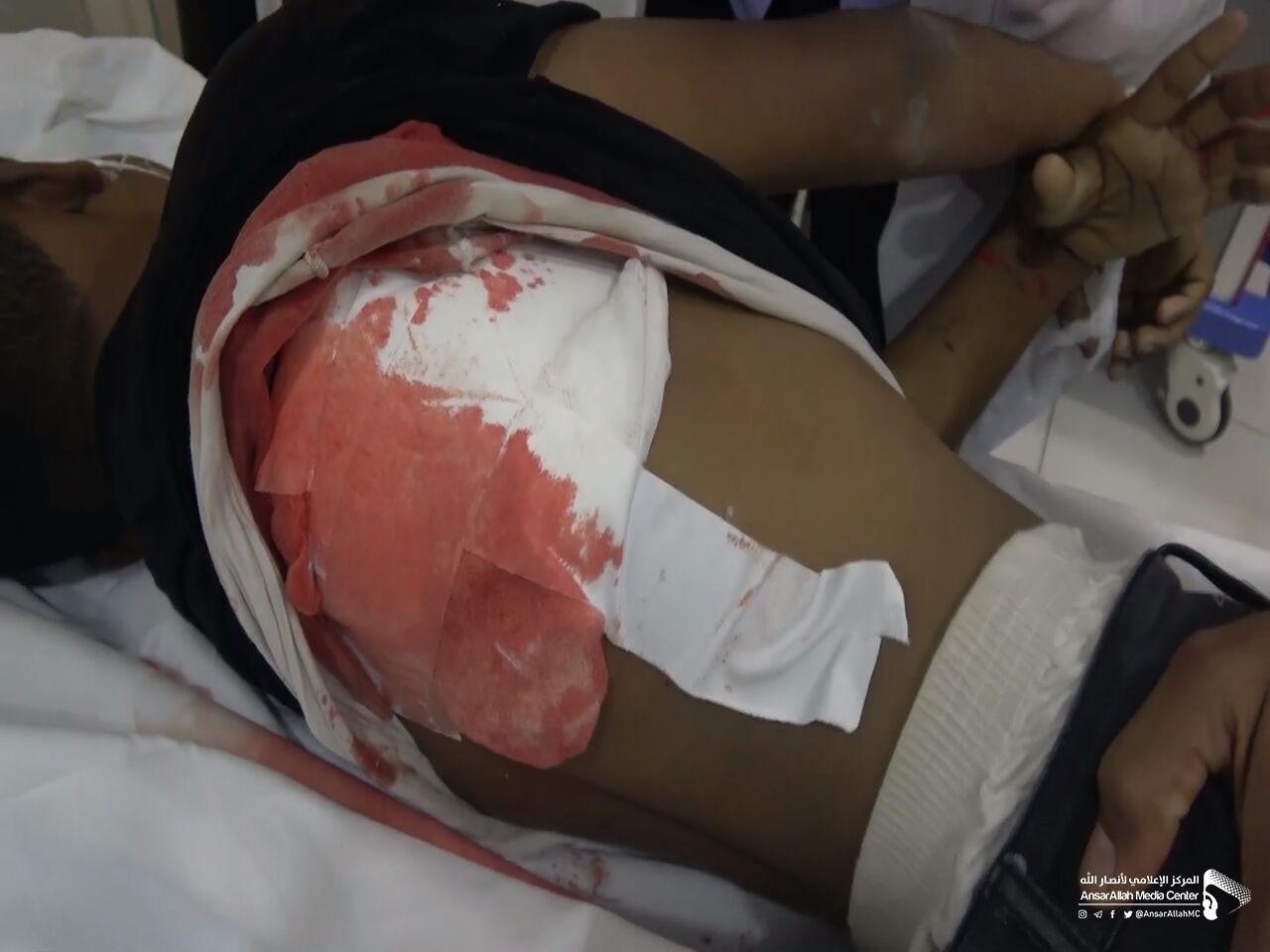 جريمة للعدوان السعودي خلفت ضحايا مدنيين بينهم طفل في الحديدة+(صور)