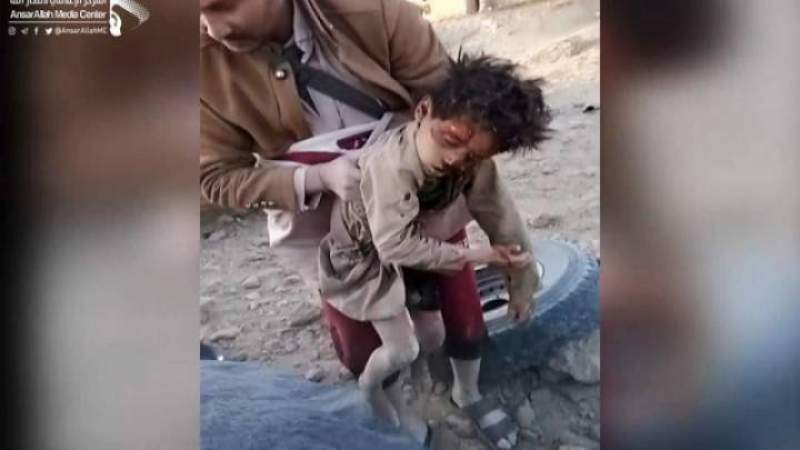 وزارة الصحة تُعلن الحصيلة النهائية لجريمة العدوان بحق المدنيين في الجوف 