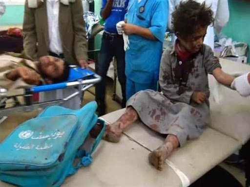 استشهاد 19 طفلاً بغارات للعدوان السعودي في اليمن