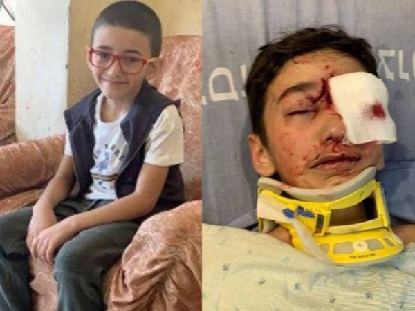Budak 8 Tahun Buta Ditembak Tentera Zionis