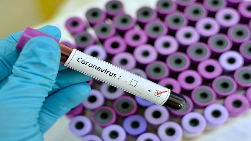 Siap produksi, Kemhan Iran Buat Detektor Virus Corona