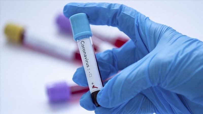 USA verhindern den Medikamententransfer zur Behandlung von durch Coronavirus infizierten Menschen im Iran