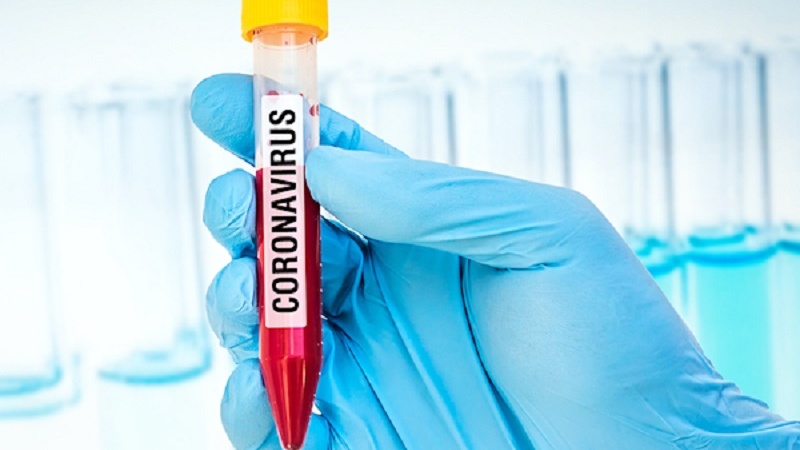 Russland schickt 50.000 Coronavirus-Testkits nach Iran