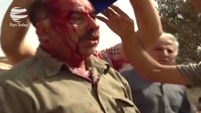 Coloni sionisti attaccano e feriscono 3 palestinesi