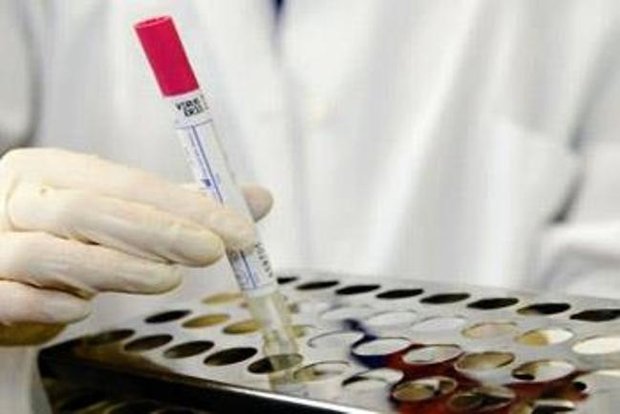 Azerbaycan'da kovid-19'a karşı önlemler kapsamında özel karantina kararı