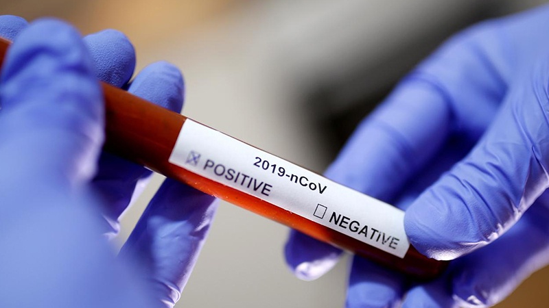 Iran Berhasil Pecahkan Kode Genetik Virus Corona
