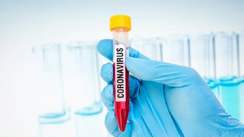 Yemen: due vittime per coronavirus