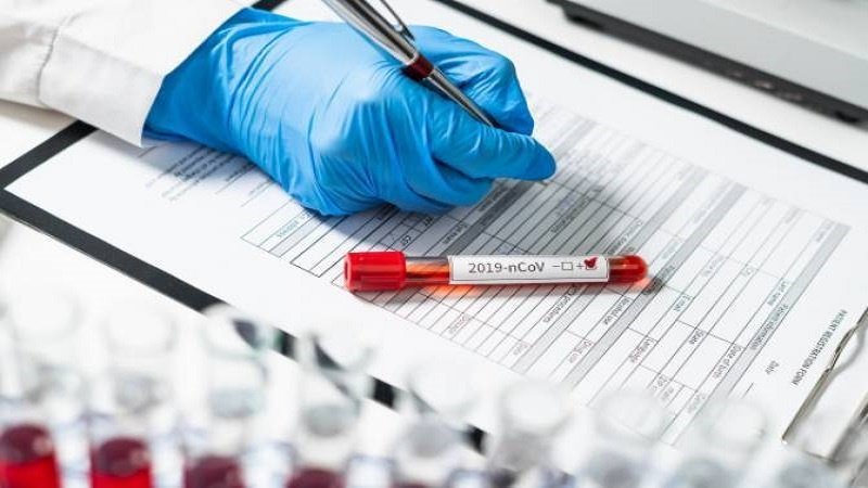 Iran al terzo posto nel mondo per ricerca sul coronavirus