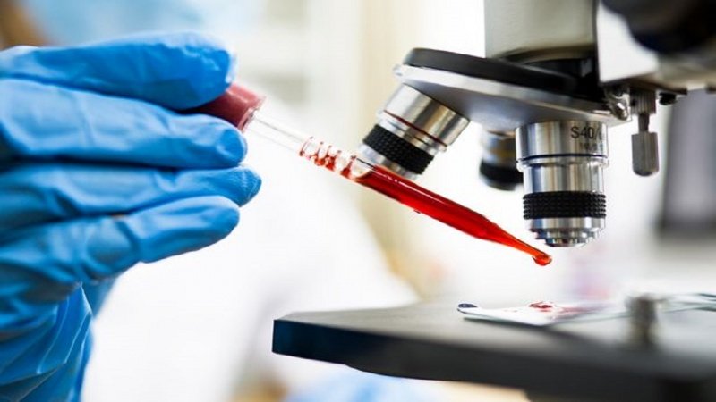 Coronavirus: America Latina,15.000 morti