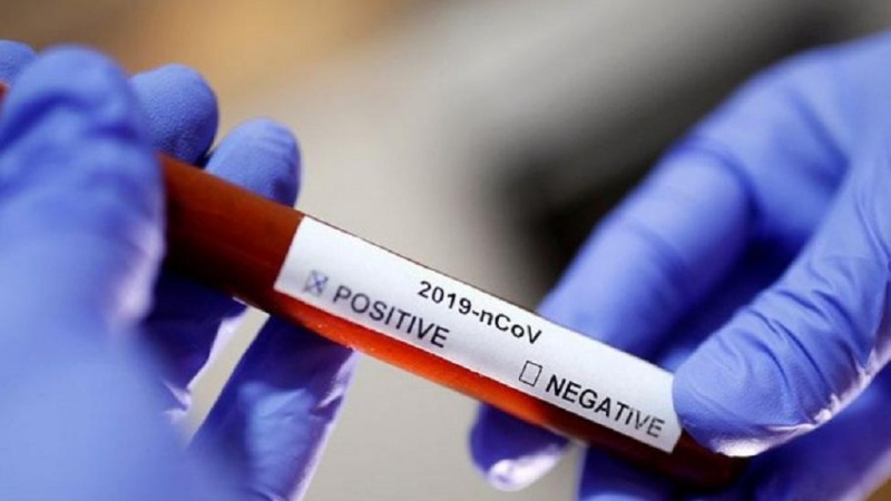 İranda 119 min koronavirus xəstəsi sağalıb