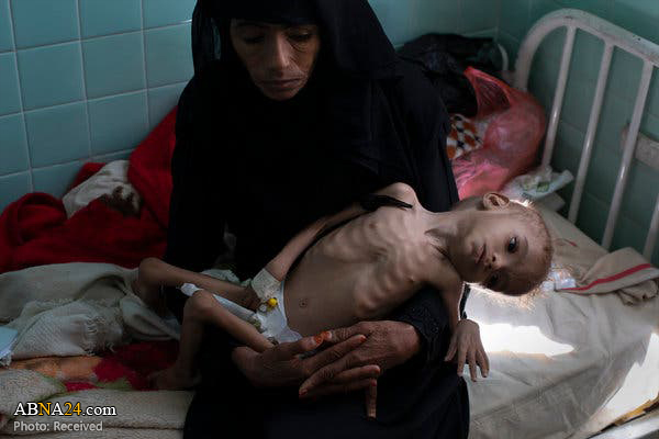 UN: Millions of Yemeni children on 'brink of starvation' UN: Millions of Yemeni children on 'brink of starvation'