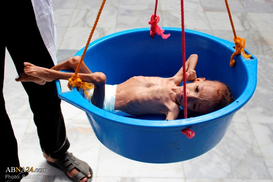 “Irán vuelve a alzar la voz de alarma contra los crímenes de Riad en Yemen” 