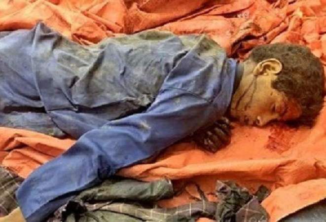 وزارة الصحة اليمنية تدين بشدة جريمة طيران العدوان في الجوف