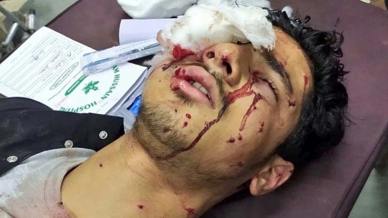  Dozens of Kashmiris injured as India cracks down on Muharram processions