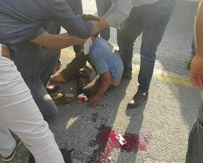 مستوطن يدهس طفلاً فلسطينياً في الخليل