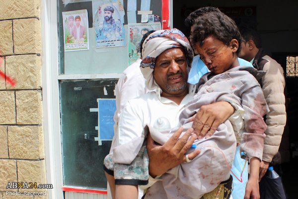 7250 children killed, injured by Saudi aggression since March 2015