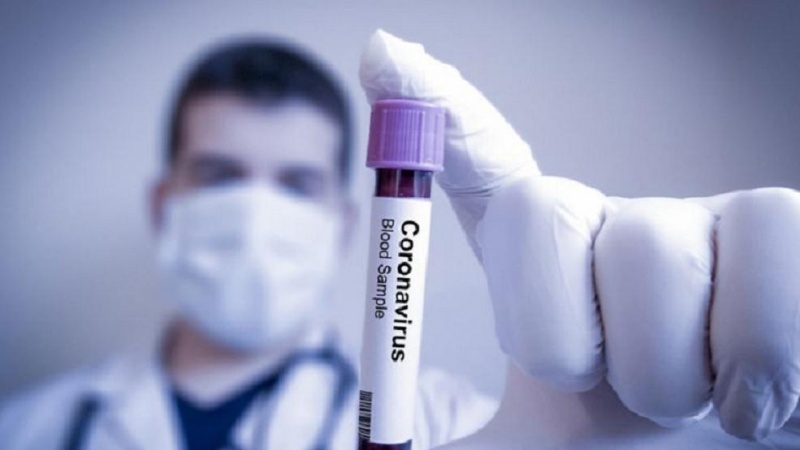 Азәрбајҹан Республикасында сон суткада 139 нәфәр коронавируса јолухуб