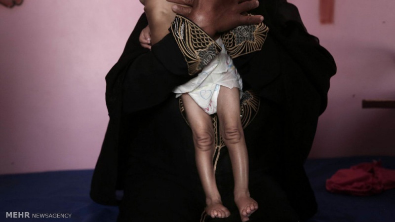 Yemen, tre milioni di disabili a rischio morte