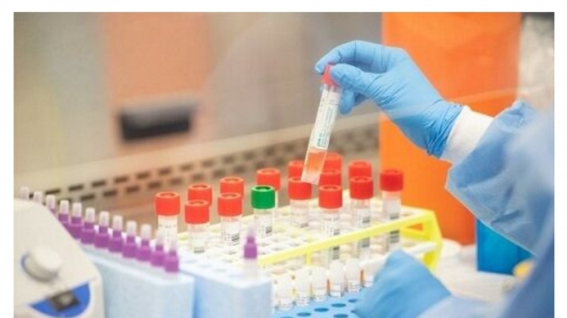 Koronavirüsün Hızlı Tanı Testi Kiti İran'da Yapıldı