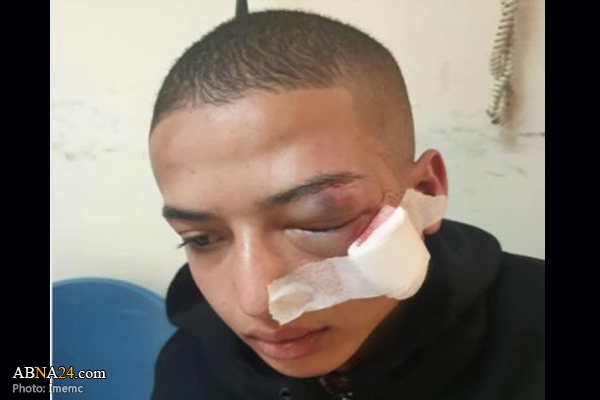 Israeli forces ahoot Palestinian teen in Jerusalem al-Quds