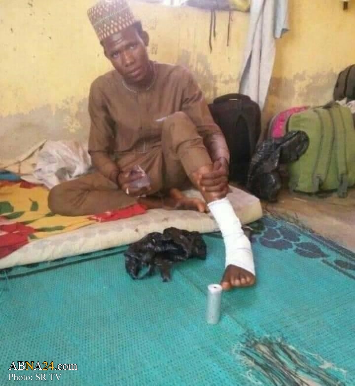 Photos: Nigerian forces attack 'Free Zakzaky' peaceful protest in Abuja 
