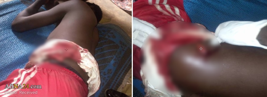 Nigerian police shoot another followers of Sheikh Zakzaky In Abuja (+Photos)