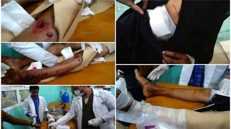 إصابة 3 أطفال بانفجار قنبلة عنقودية من مخلفات العدوان في صعدة 