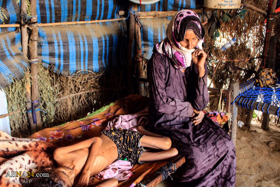 Over 16 million people in war-torn Yemen to go hungry this year: UN