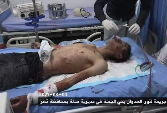 اليمن: شهداء وجرحى بقصف للمرتزقة على صالة في تعز